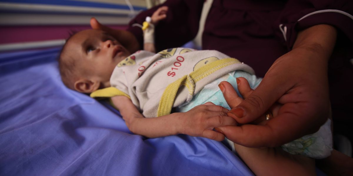 Gaza starvation children